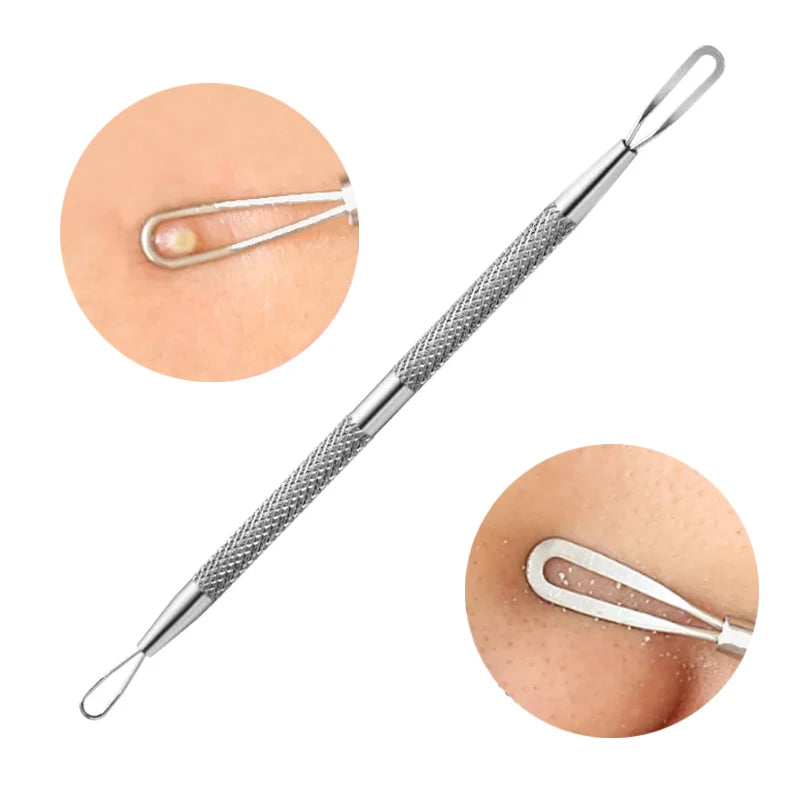 1/2/3pcs German Ultra-fine Cell Pimples Blackhead Whitehead Clip Beauty Face Salon Special Remove Acne Fat Particles Needle Tool