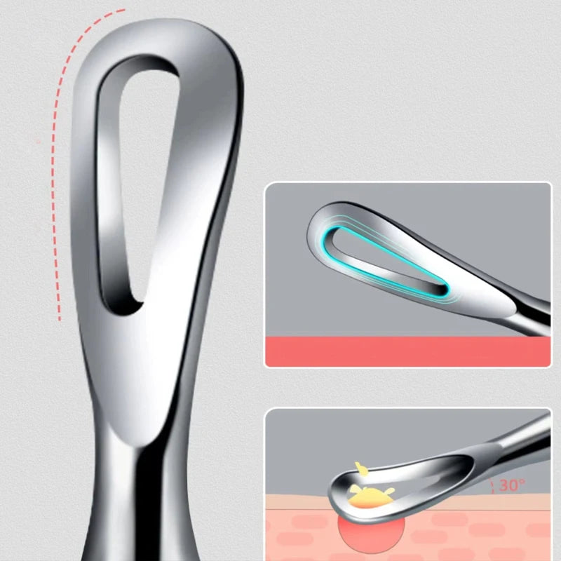 1/2/3pcs German Ultra-fine Cell Pimples Blackhead Whitehead Clip Beauty Face Salon Special Remove Acne Fat Particles Needle Tool