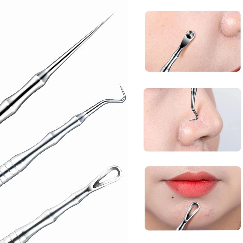 1/2/3pcs German Ultra-fine Cell Pimples Blackhead Whitehead Clip Beauty Face Salon Special Remove Acne Fat Particles Needle Tool