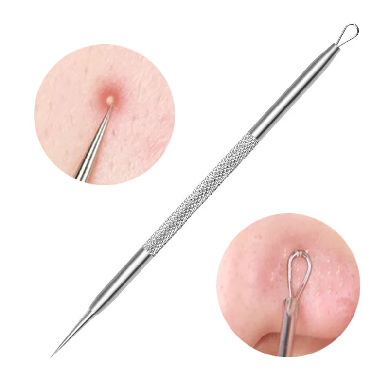 1/2/3pcs German Ultra-fine Cell Pimples Blackhead Whitehead Clip Beauty Face Salon Special Remove Acne Fat Particles Needle Tool