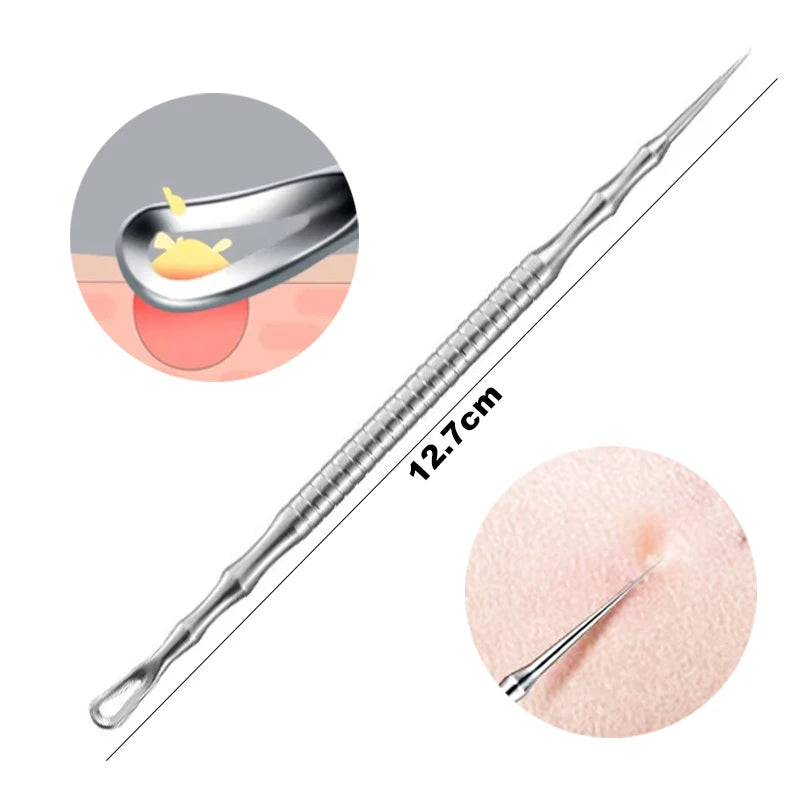 1/2/3pcs German Ultra-fine Cell Pimples Blackhead Whitehead Clip Beauty Face Salon Special Remove Acne Fat Particles Needle Tool